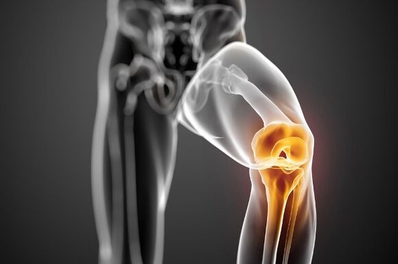Osteoarthritis of the knee joint