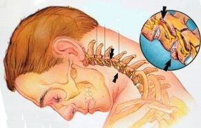 Cervical service