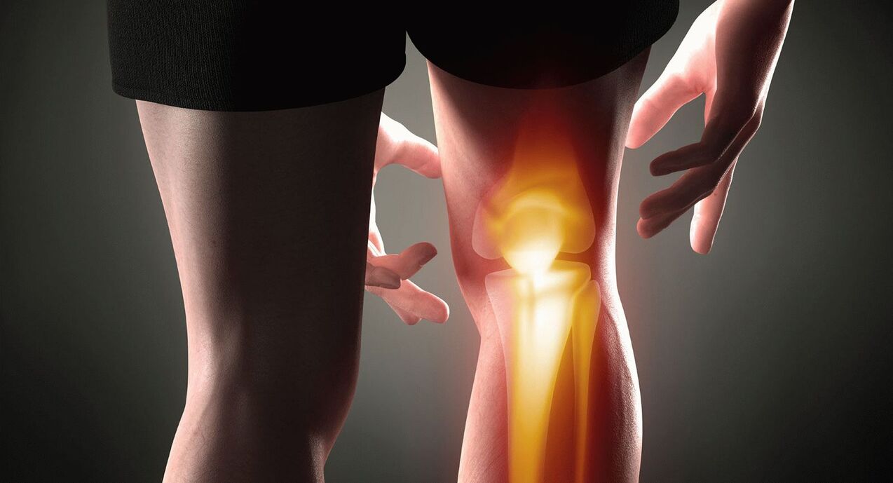 osteoarthritis symptoms